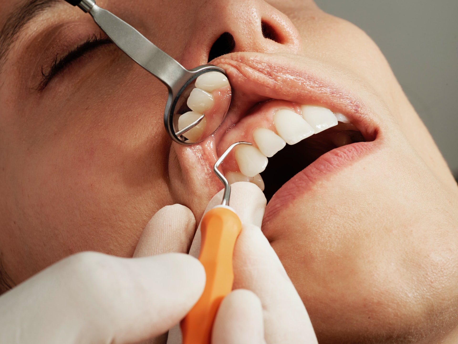 Jak często odwiedzać stomatologa?